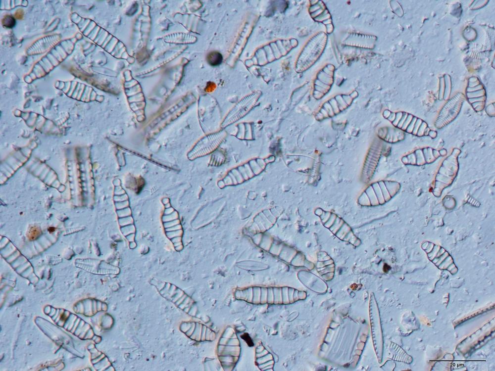 diatoms microscopic image - diatoms ocean acidification